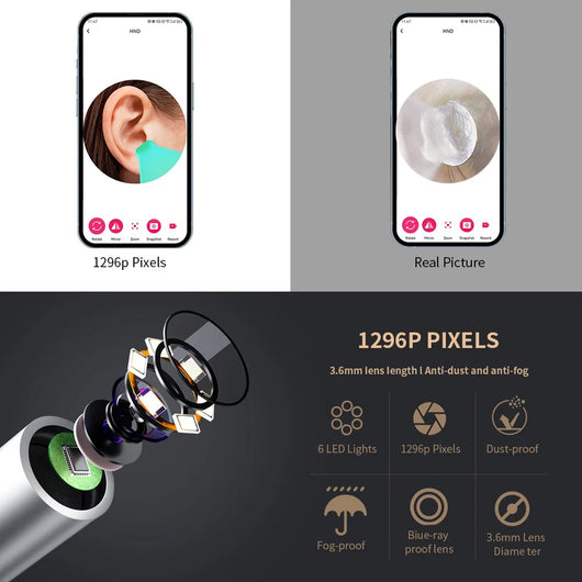AquaClear™ Smart Visual Ear Cleaner with Camera